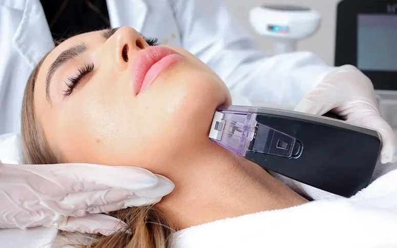 Morpheus 8: инновационный игольчатый RF-лифтинг для лица и тела