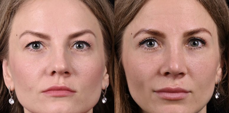 Обзор видов ножничных подъемников и их назначение для промышленности и строительства