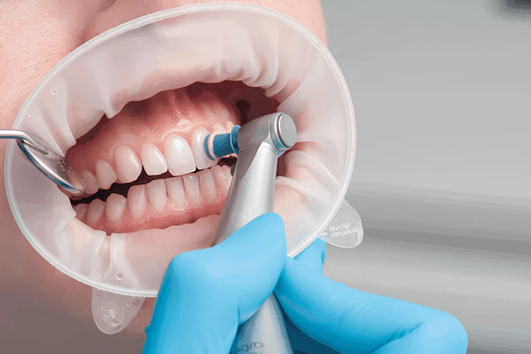 Правила и советы по профессиональной чистке зубов для здоровья и красоты улыбки